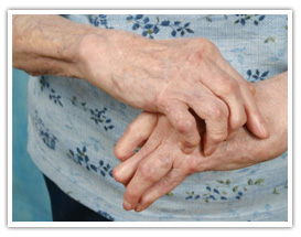 Rheumatoid Arthritis