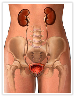  Urinary Tract Infection